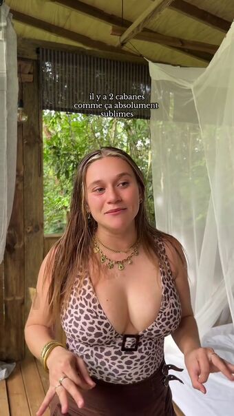 Justinaccessible Foto Nua Vazada OnlyFans 111